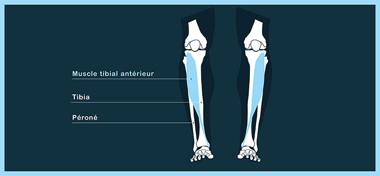 tibial-periostitis-pain-running-leg